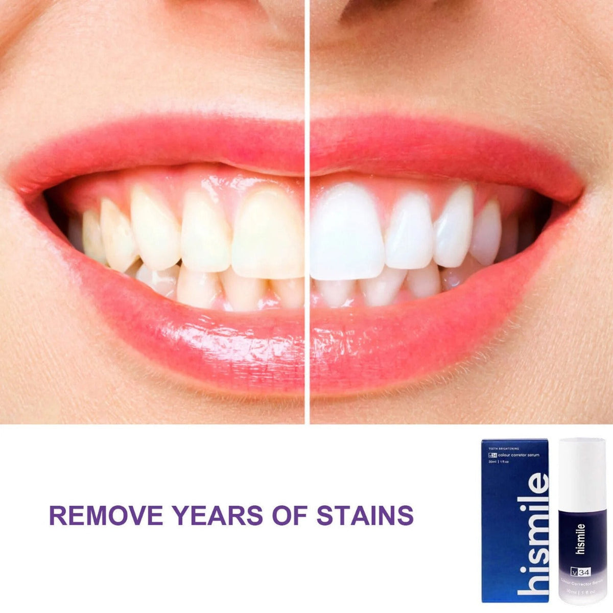 Hismile Purple Teeth Whitening Toothpaste – Oral Care & Bright Smile