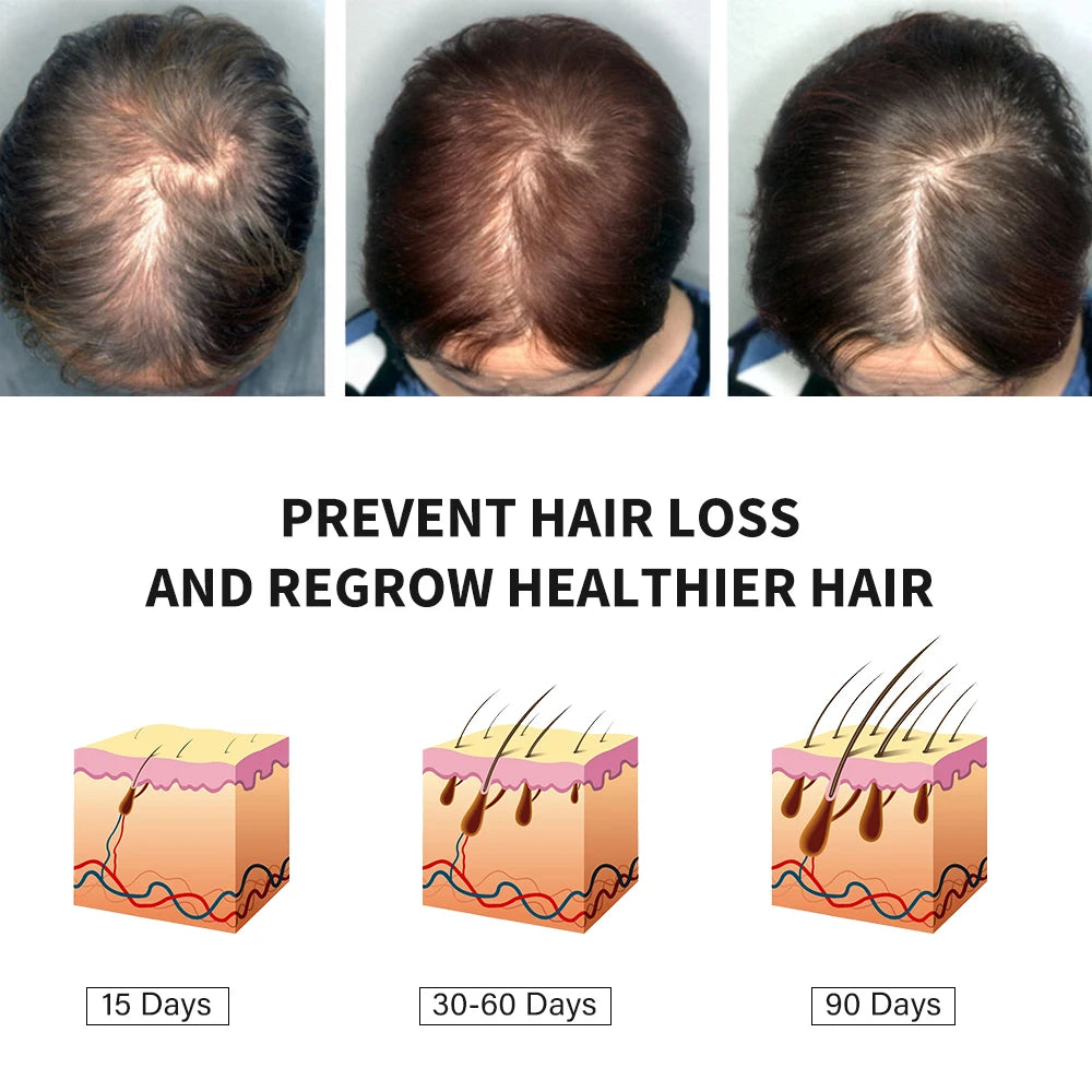 Original 7 Days Hair Growth Germinal Serum Oil – 30ML