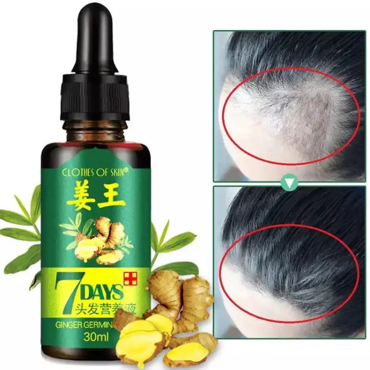 Original 7 Days Hair Growth Germinal Serum Oil – 30ML